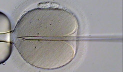Bei künstlicher Befruchtung wird wird ein Spermium mit einer Pipette (rechts) in eine Eizelle injiziert. Wird anschließend mit Hilfe der Genom-Editierung das Erbgut der befruchteten Eizelle verändert, wird die Mutation auch an die folgenden Generationen weitergegeben. Solche Eingriffe in die Keimbahn sind ethisch fragwürdig und werden von vielen Wissenschaftlern abgelehnt.