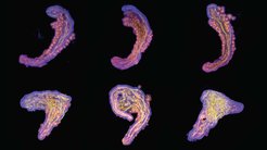 Collage von Stammzell-basierten Embryo-Modellen des embryonalen Rumpfes. Die in der oberen Reihe haben einen Hang zu Süßem, sind also stärker auf Glykolyse angewiesen, um ihre Energie zu gewinnen, was zu einem eher embryonalen Erscheinungsbild führt. Im Gegensatz dazu haben die in der unteren Reihe einen geringeren Hang zu Süßem, was dazu führt, dass sie zu viel Nervengewebe produzieren und weniger wie ein embryonaler Rumpf aussehen.